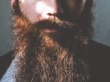 Le Minoxidil est-il efficace pour la barbe ?